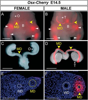 A transgenic bacterial artificial chromosome approach to identify regulatory regions that direct Amhr2 and Osterix expression in Müllerian duct mesenchyme